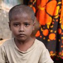 Child with shaved head, poor neighborhood within Dhaka